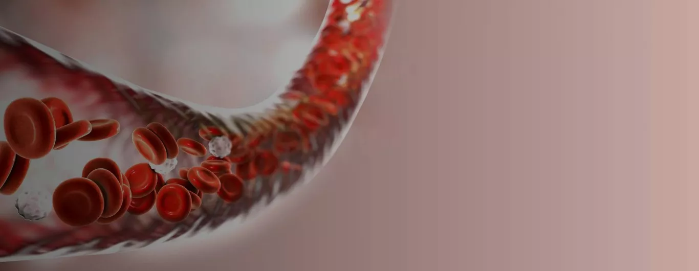 vascular surgery in bangalore